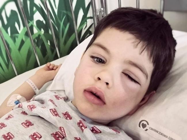 Kiełpino. 3-letni Antoś walczy ze złośliwym nowotworem. Trwa zbiórka