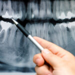 Jak działa nowoczesna diagnostyka obrazowa w stomatologii??