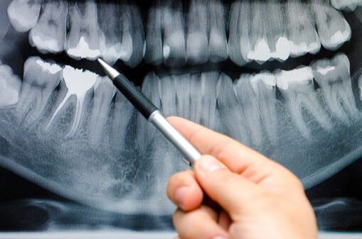 Dentist showing something on dental x-ray image on computer monitor.