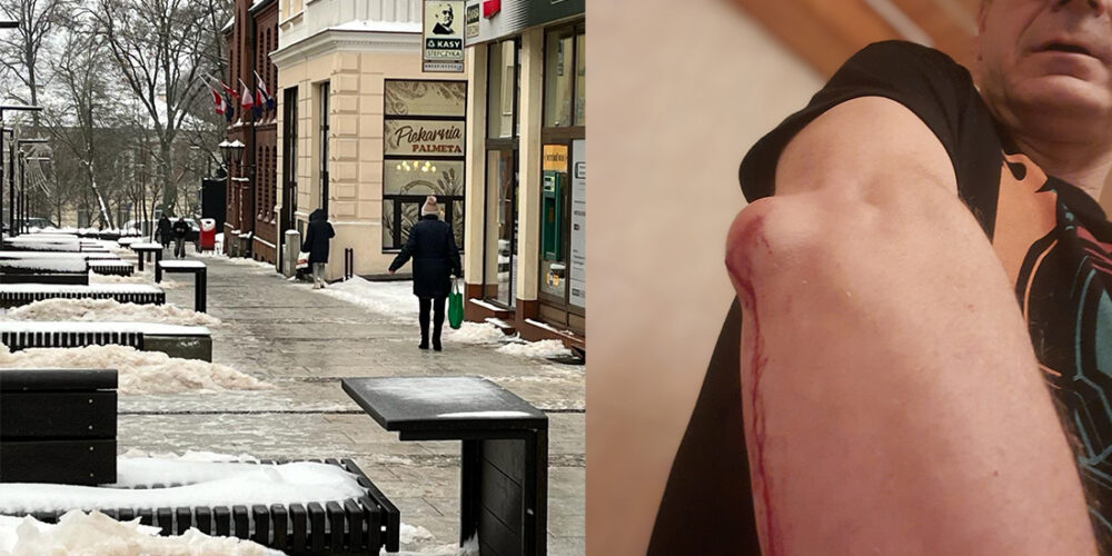 Kartuski urząd podpowiada, co zrobić w przypadku „kraksy” na deptaku